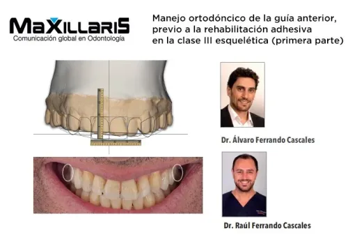 maxillaris-publicacion