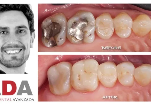 noticia-ada-clinica-dental